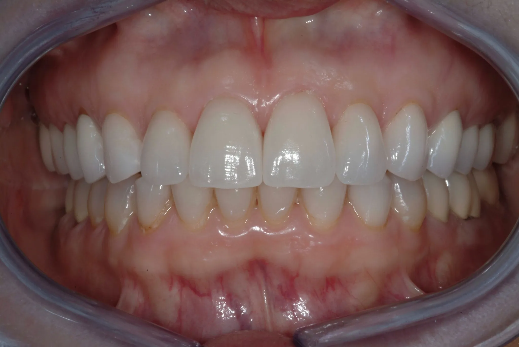 Aesthetic / Cosmetic Dentistry image