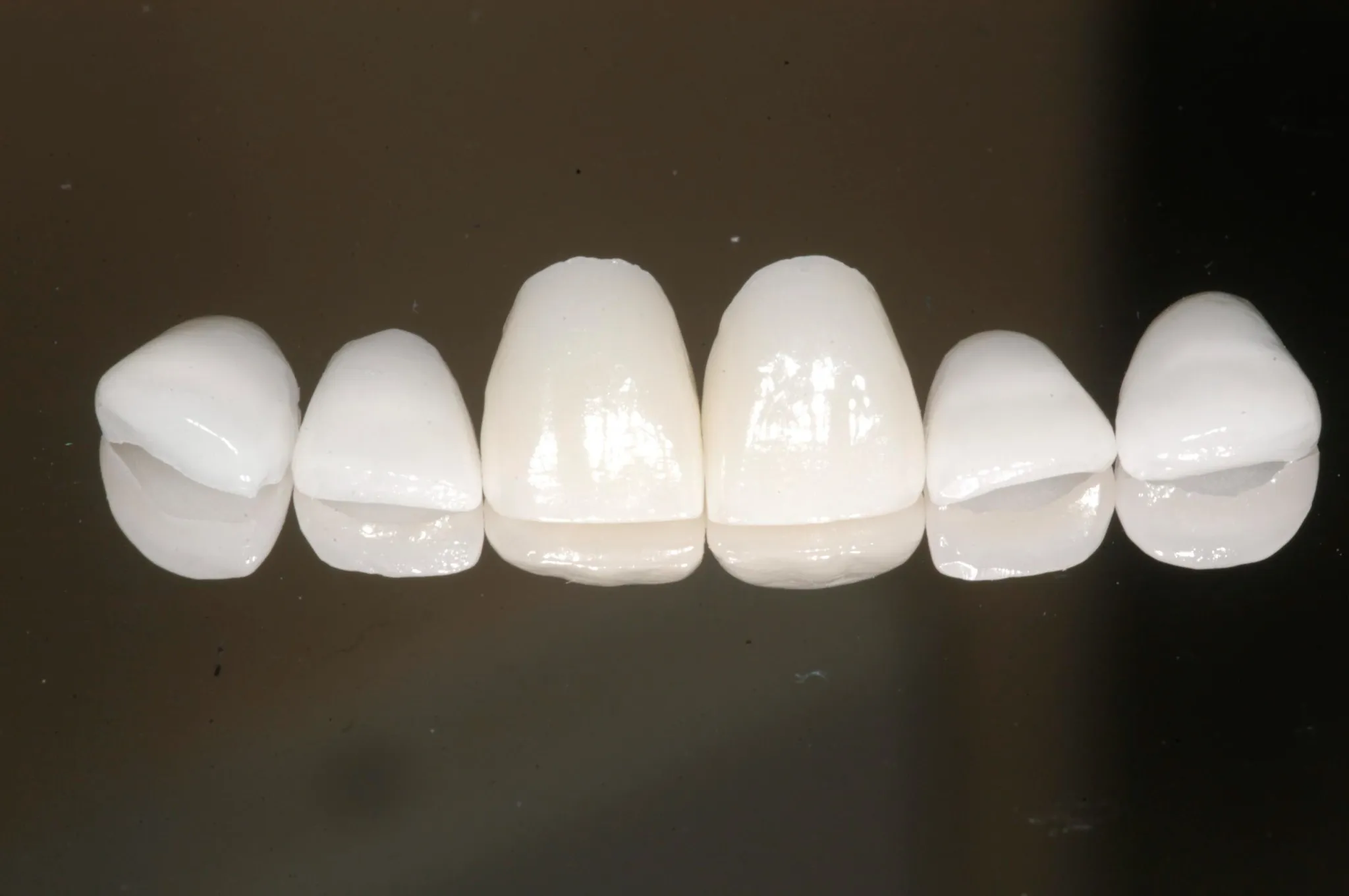 Veneers image