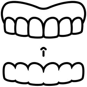 Mandibular Advancement Device