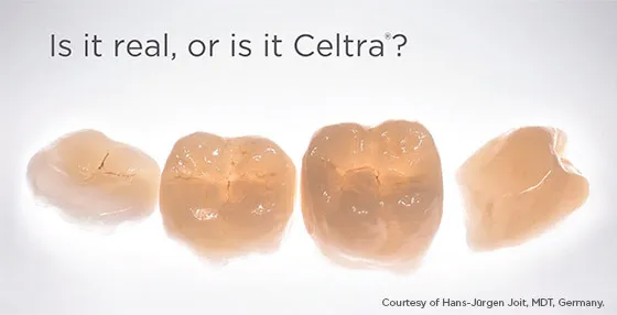 Dentistry Palo Alto CA Teeth Model